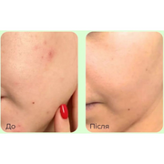 Заспокійлива тонік-есенція для обличчя з PDRN та центелою MEDIPEEL Young Cica PDRN Trouble Soothing Essence Toner, 200 мл