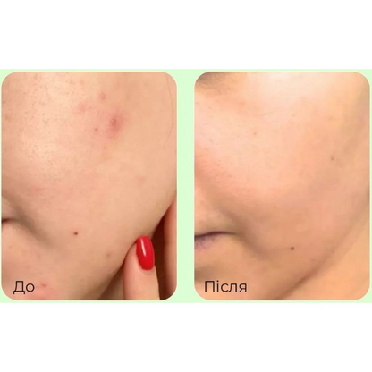 Заспокійлива тонік-есенція для обличчя з PDRN та центелою MEDIPEEL Young Cica PDRN Trouble Soothing Essence Toner, 200 мл