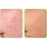 Заспокійливий крем з PDRN і центеллою MEDIPEEL Young Cica PDRN Trouble Soothing Cream, 80 мл